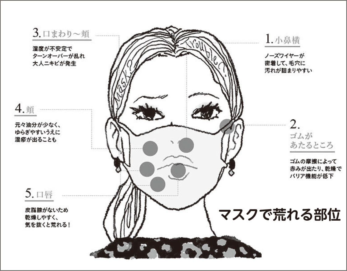 マスクによる肌荒れ 認定看護師が伝える 健康に関するまめ知識 沖縄医療生活協同組合